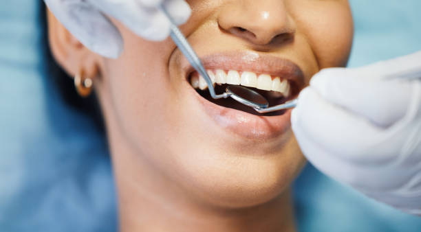 Best Tooth Infection Emergency Dentist  in Paonia, CO